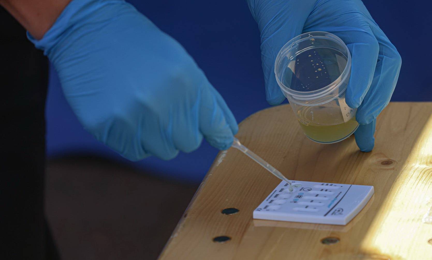 Bild eines Drogentests.