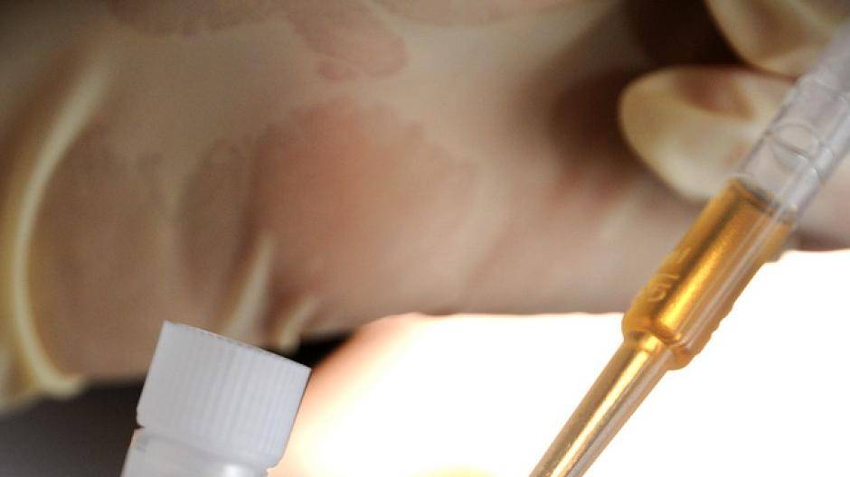 Alle Blutspenden werden regelmäßig auf Infektionskrankheiten...