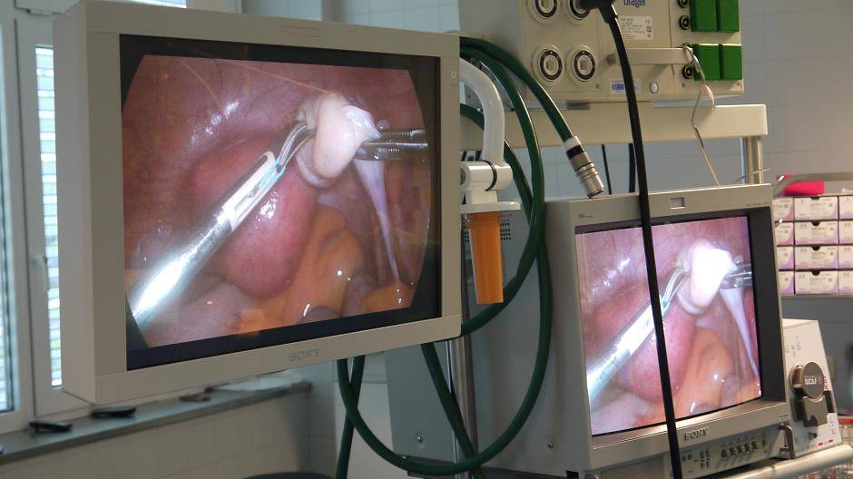 Auf den hochauflösenden Bildschirmen lässt sich genau erkennen, wo welcher Schnitt...