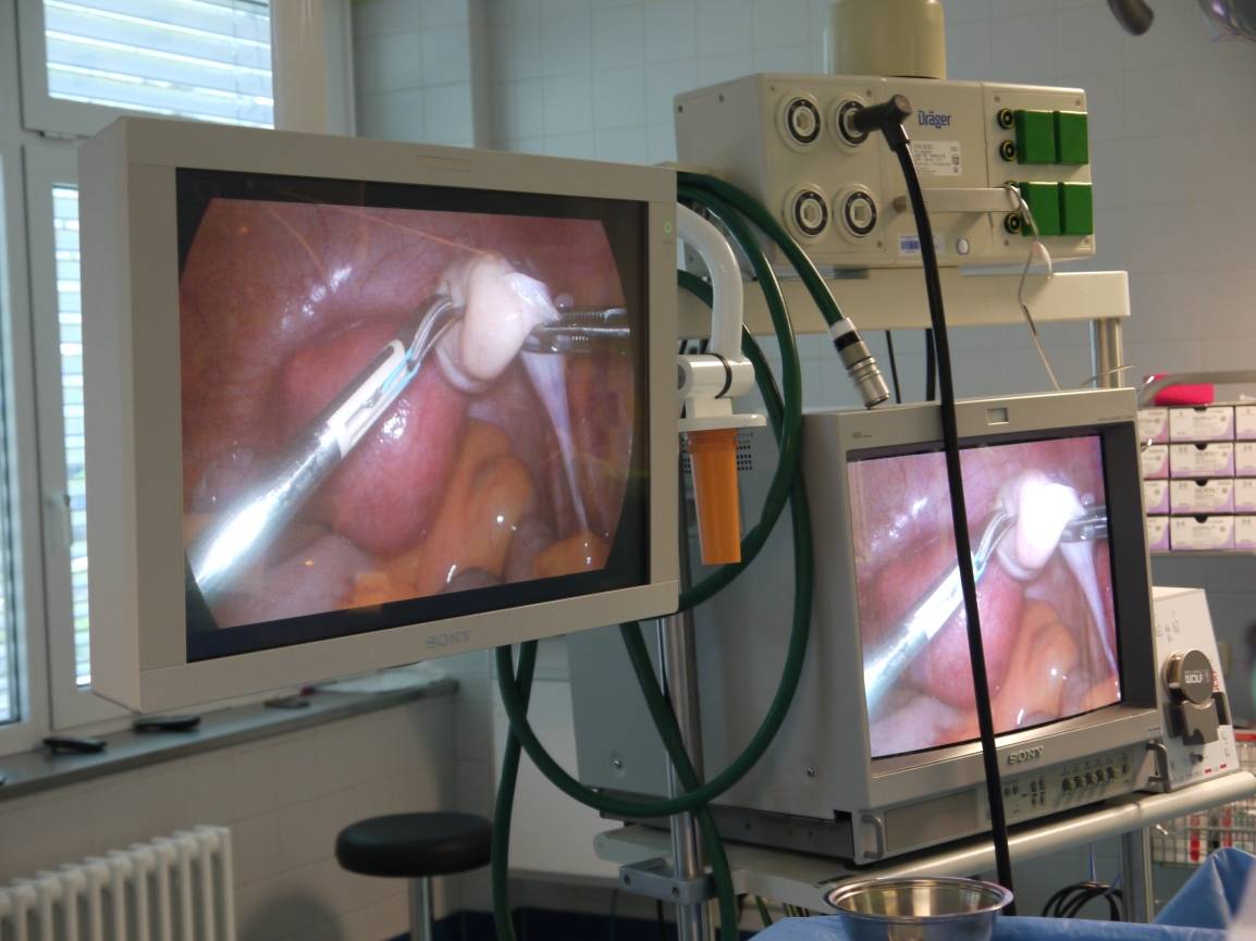 Auf den hochauflösenden Bildschirmen lässt sich genau erkennen, wo welcher Schnitt...