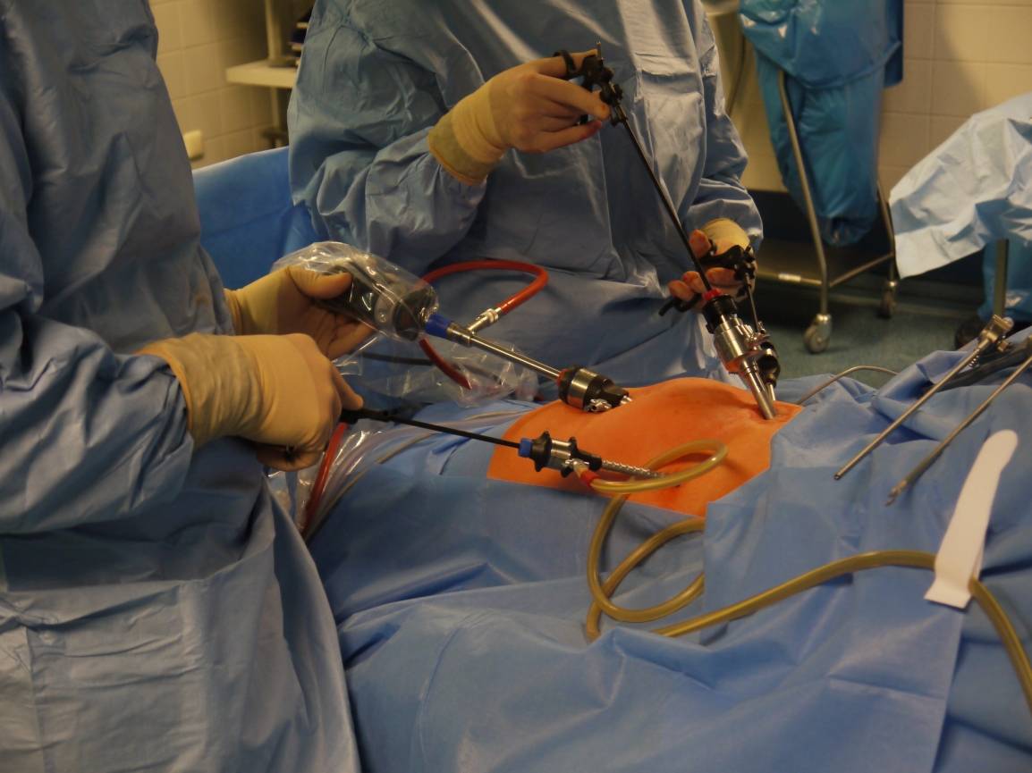 Drei kleine Schnitte mit der Länge von circa 1cm sind notwendig, um die OP...