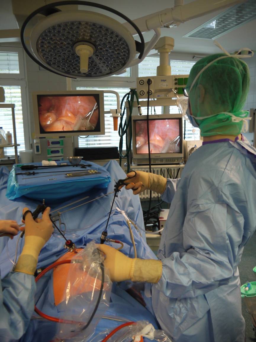 Blick auf den Monitor, der jeden Handgriff im Bauchinneren...